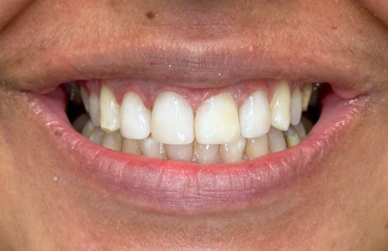 After -212 Dental Studio