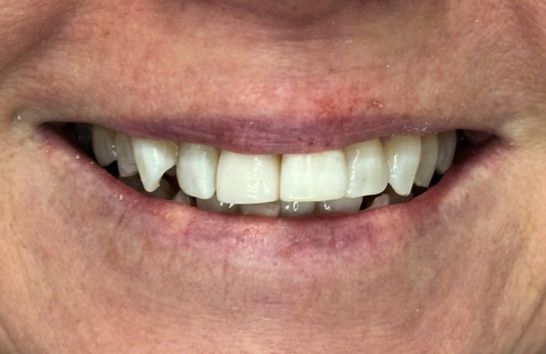 After -212 Dental Studio