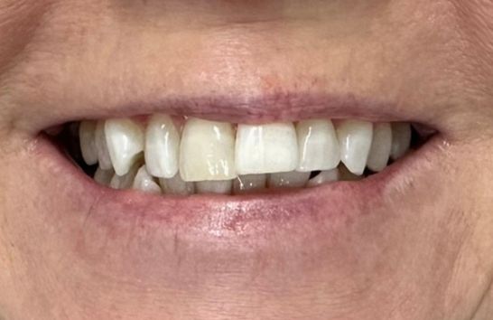 Before - 212 Dental Studio