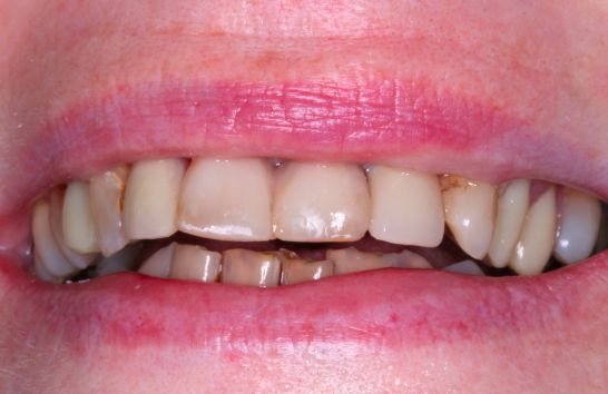 After -212 Dental Studio