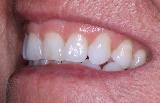 After -212 Dental Studio