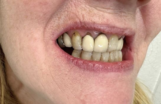 Before - 212 Dental Studio