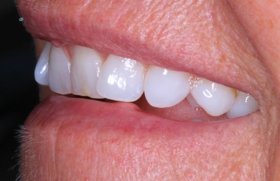 Before - 212 Dental Studio