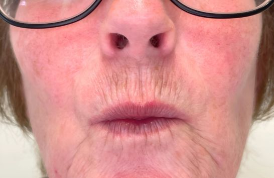 Before - 212 Dental Studio