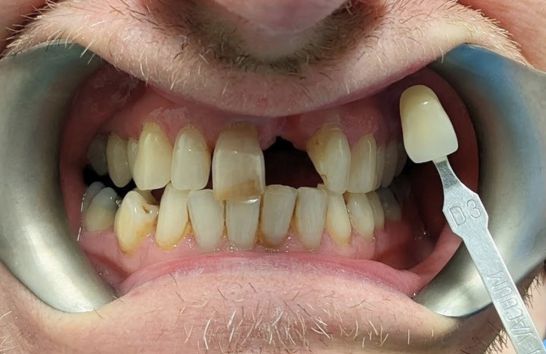 Before - 212 Dental Studio