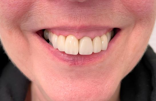 After -212 Dental Studio