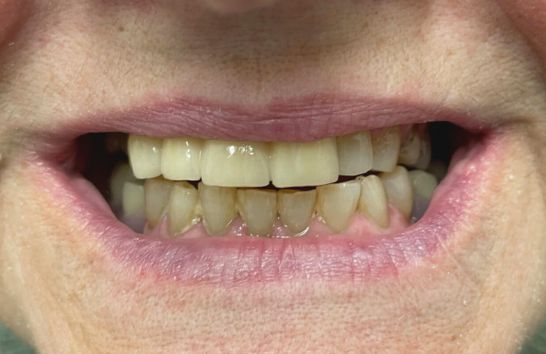 After -212 Dental Studio