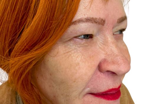 After -212 Dental Studio