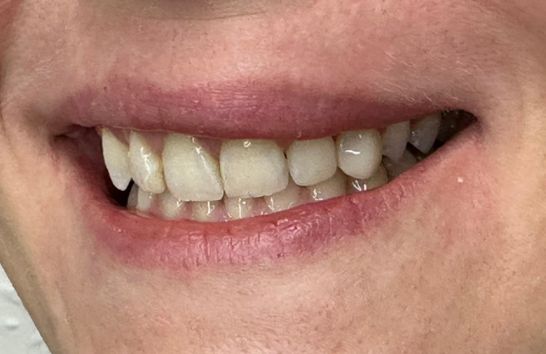 After -212 Dental Studio