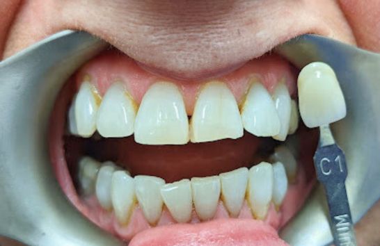 After -212 Dental Studio