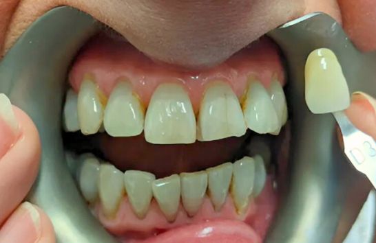 Before - 212 Dental Studio